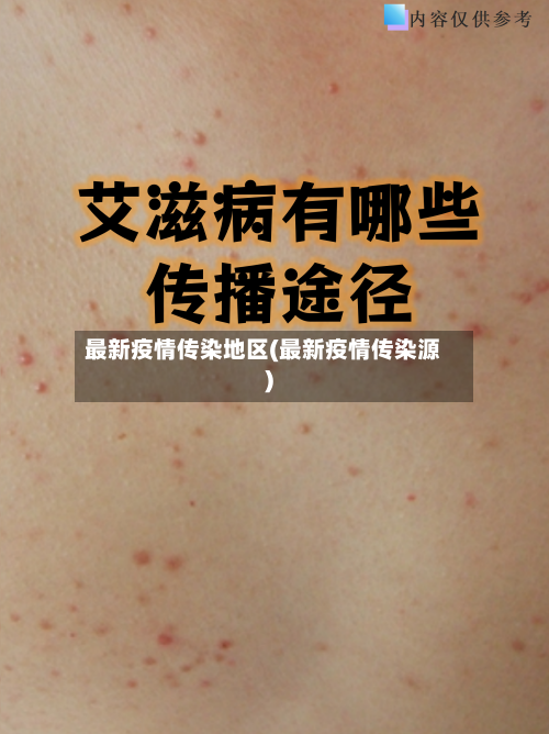 最新疫情传染地区(最新疫情传染源)-第3张图片